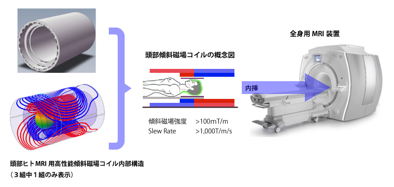 頭部ヒトMRIに用いる高性能傾斜磁場コイルの設計・製作