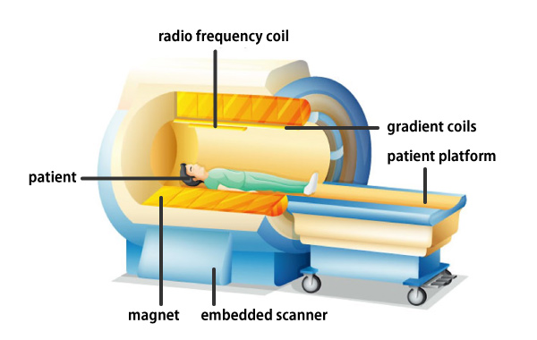 Design and fabrication of high-performance gradient magnetic field coils for brain MRI